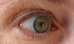 Александр Сысуев: правила защиты глаз от акантамебы и кератита aleksandr sysuev pravila zashhity glaz ot akantameby i keratita-ul-rks-ru-0