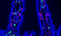 Химиотерапия и микрофлора кишечника против метастазов himioterapiya i mikroflora kishechnika protiv metastazov-ul-rks-ru-0