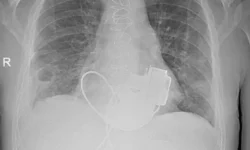 Операция в Мариинской: Реутский и Хубулава спасли пациента operacziya v mariinskoj reutskij i hubulava spasli paczienta-ul-rks-ru-0