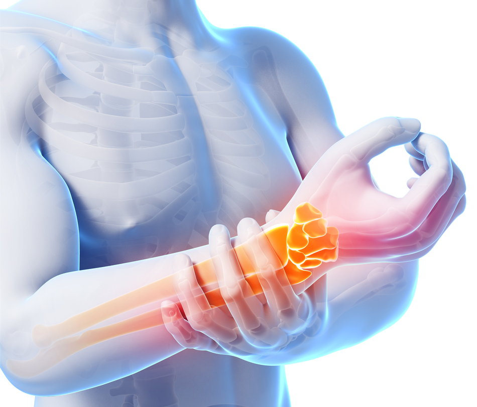 Акция "Здоровые суставы"