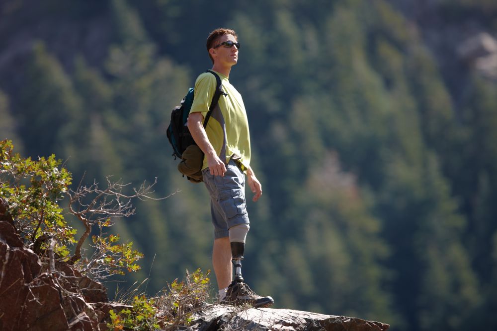 Протезы нижних и верхних конечностей по электронному сертификату