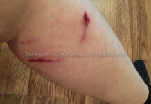 Инцидент с бродячей собакой в Кузбассе: подросток госпитализирован 4bd5113d-0888-4897-ab48-abf327f17f35-676b05fa