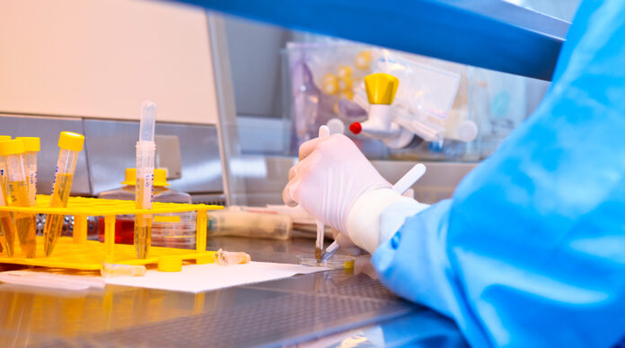 Urine samples