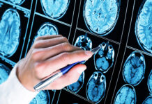 Ученые нашли зону мозга, отвечающую за страх опозориться на публике 0e8ef382-6a66-4361-9002-0a32fbe44912-67955f93