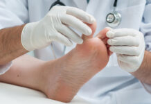 Прорыв в борьбе с грибковыми инфекциями: найден способ многократно усилить действие лекарств 4caa8f9e-060a-4078-b208-cecd29ab2c54-677fa073