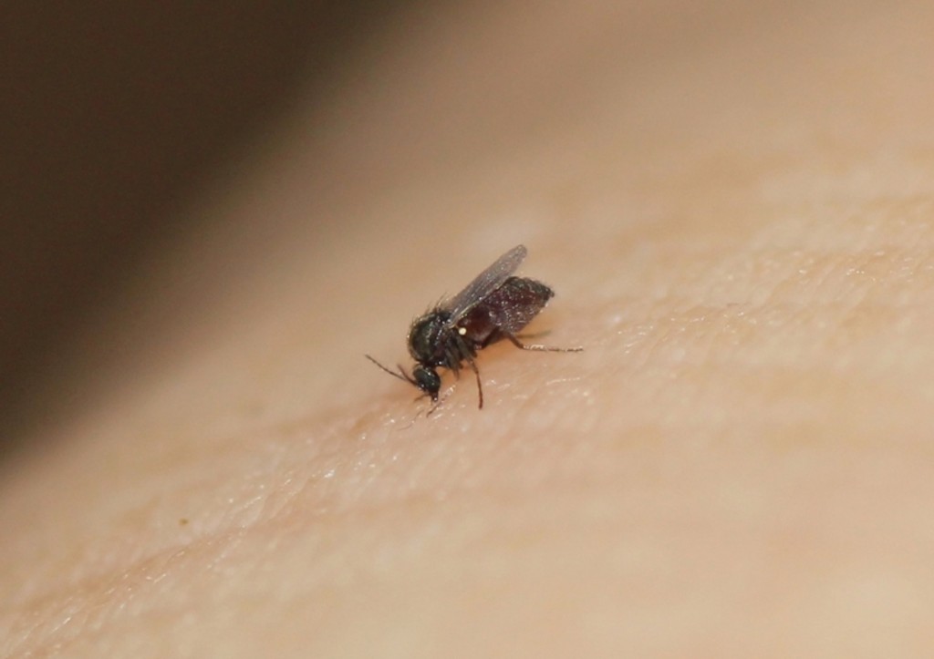 Женщина чуть не осталась без ноги из-за укуса мошки в Подмосковье