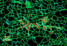 Нинг Ван и YAP обсуждают роль актин и CTGF в клеточной памяти биоинженерии ning van i obsuzhdayut rol aktin i v kletochnoj pamyati bioinzhenerii-ekaterinburgu-ru-174604302100-0
