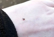 Свердловская область активно борется с клещевым энцефалитом и лайм-боррелиозом sverdlovskaya oblast aktivno boretsya s kleshhevym enczefalitom i lajmborreliozom-ekaterinburgu-ru-174772045000-0