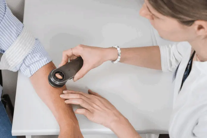 Свердловский областной онкологический диспансер акцентирует внимание на ранней диагностике кожных заболеваний-0