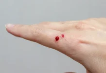 Бирмингемский университет и Симран Равал открывают динамику клеток при заживлении ран birmingemskij universitet i simran raval otkryvayut dinamiku kletok pri zazhivlenii ran-ekaterinburgu-ru-0