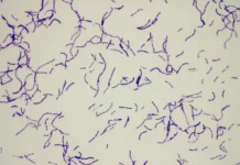 solnechnyj svet i zhelezo sposobstvuyut borbe s bakteriyami i antibiotikami-ekaterinburgu-ru-0