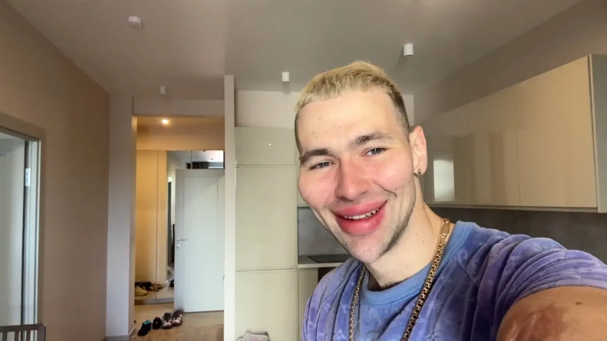 СМИ: Кириллу Руки-Базуки грозит ампутация конечностей