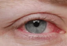 Иван Зарубин из Красногорской больницы даёт советы по защите зрения ivan zarubin iz krasnogorskoj bolniczy dayot sovety po zashhite zreniya-ekaterinburgu-ru-0