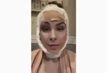 Анастасия Швецова, жена Natan, раскрыла секрет пластики и липофилинга anastasiya shveczova zhena raskryla sekret plastiki i lipofilinga-ekaterinburgu-ru-0