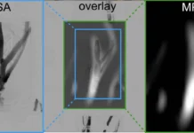 vyurczburgskij universitet primenyaet magnitnochastichnuyu tomografiyu-ekaterinburgu-ru-0