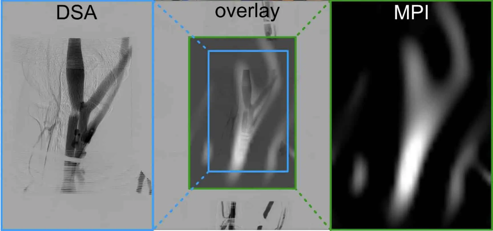 Вюрцбургский университет применяет магнитно-частичную томографию-0