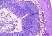 olga suhareva rasskazala o glistah immunitete i roli boleznej-ekaterinburgu-ru-0