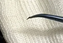 veterinary mosvetobedineniya spasli sobaku chelsi v krasnoj pahre-ekaterinburgu-ru-0