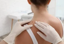dermatoskopiya pomozhet vovremya obnaruzhit agressivnye rodinki-ekaterinburgu-ru-0