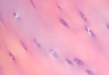 АО «Генериум» совместно с Сеченовским Университетом внедряют инновации в лечении хрящевых дефектов с использованием хондросфер ao generium sovmestno s sechenovskim universitetom vnedryayut innovaczii v lechenii hryashhevyh defektov s ispolzovaniem hondrosfer-pux-su-175162617500-0