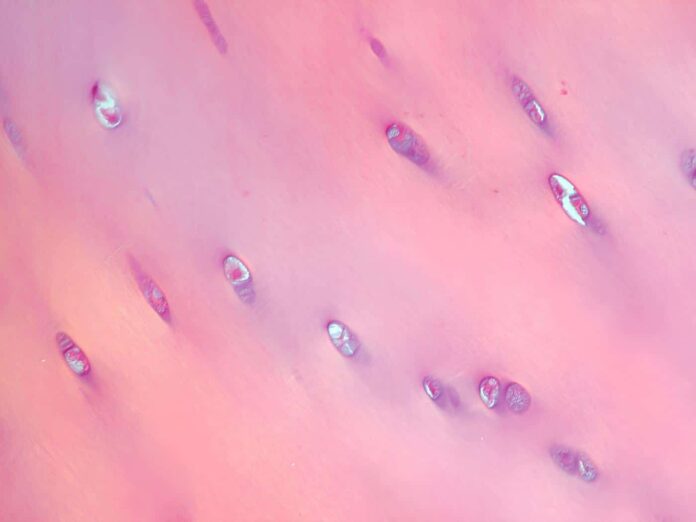 ao generium sovmestno s sechenovskim universitetom vnedryayut innovaczii v lechenii hryashhevyh defektov s ispolzovaniem hondrosfer-pux-su-175162617500-0