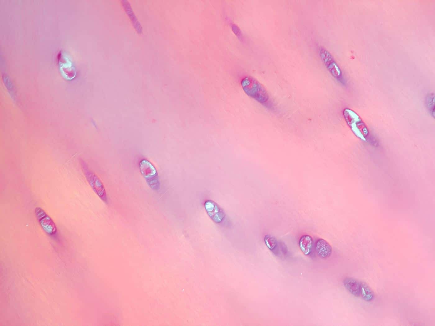 АО «Генериум» совместно с Сеченовским Университетом внедряют инновации в лечении хрящевых дефектов с использованием хондросфер-0