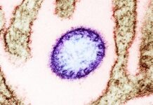 issledovanie raskryvaet novyj metod nejtralizaczii virusov nipah i hendra-pux-su-175203592900-0