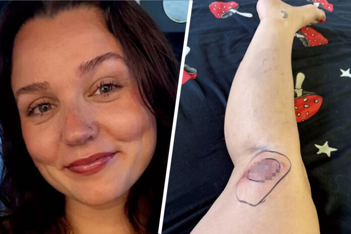 kak ukus pauka u tejlor devaprasad privel k sereznoj infekczii-pux-su-175283363600-0