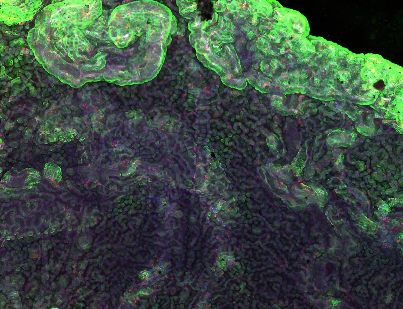 Прорывное исследование выявило связь гепатита С с рисками шизофрении и биполярного расстройства-0