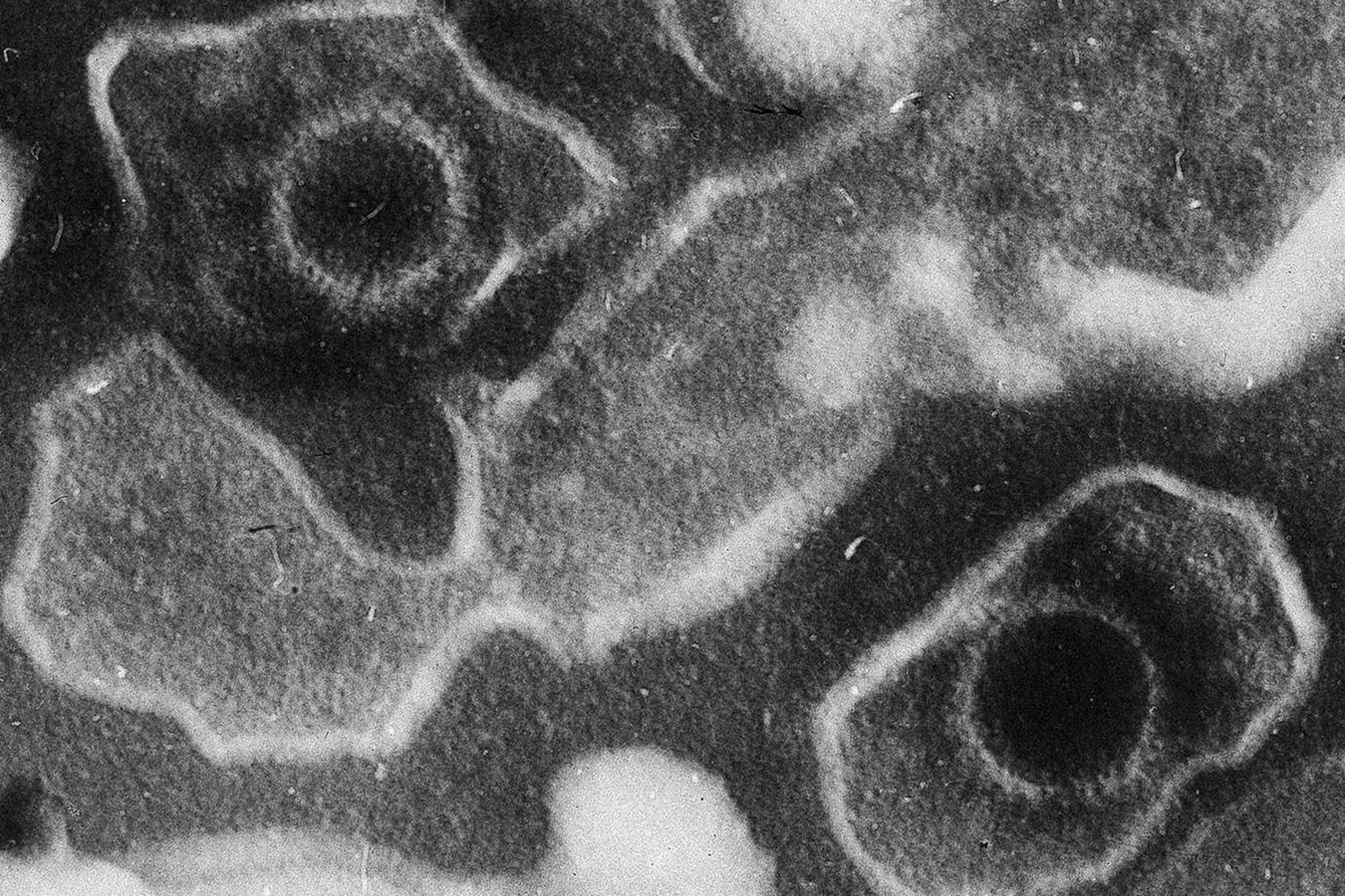 IARC сделало значительное открытие о вирусе Эпштейна-Барр в онкологии-0