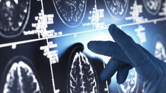 speczialisty evropejskogo mediczinskogo czentra i uchyonye nmicz pn im serbskogo delyatsya dostizheniyami v borbe s boleznyu alczgejmera-pux-su-175317414600-0