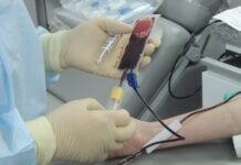 vnedryaet uspeshnuyu transplantacziyu s cziklofosfamidom v onkologii-pux-su-175264476300-0