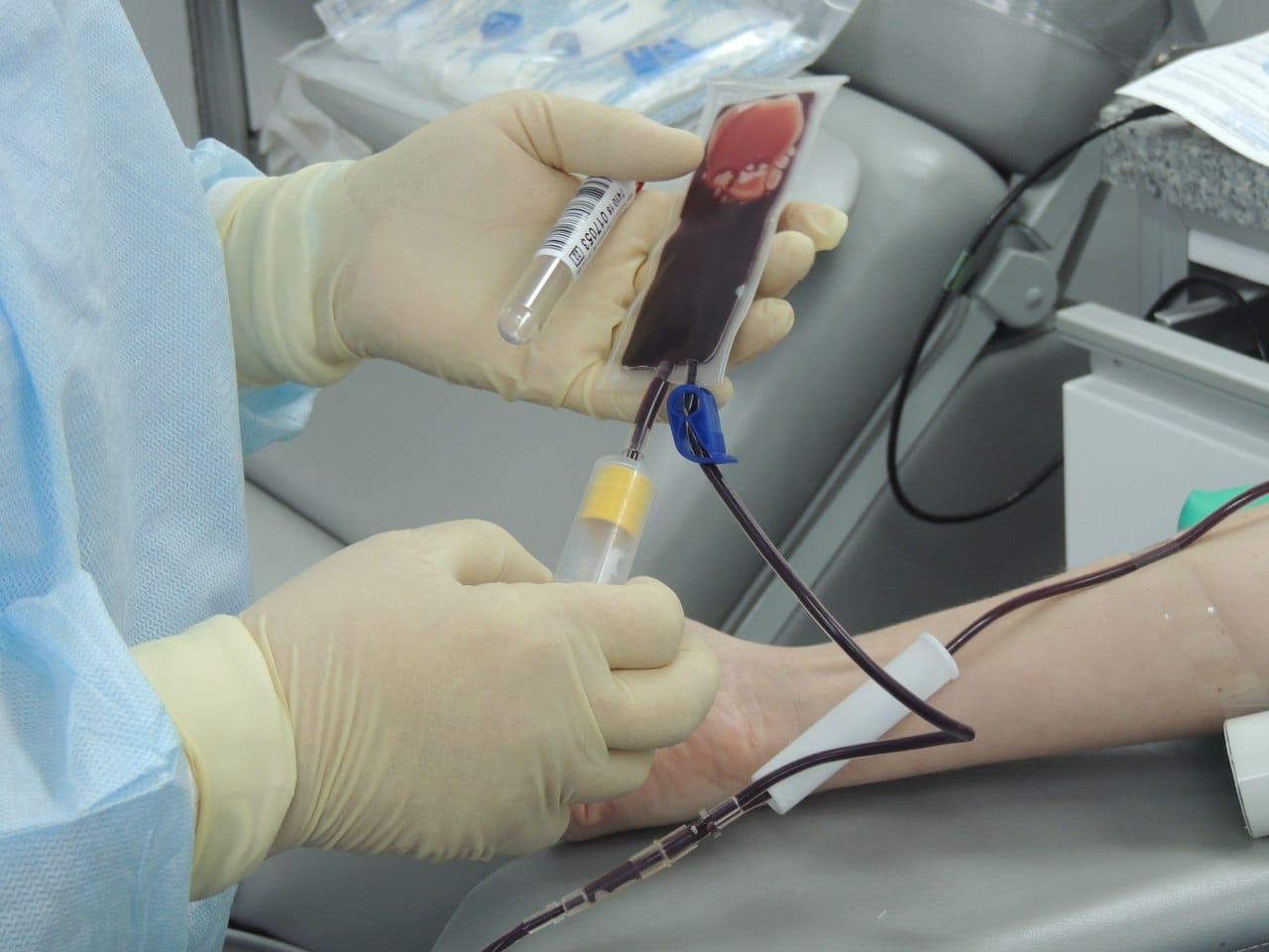 UVA внедряет успешную трансплантацию с циклофосфамидом в онкологии-0