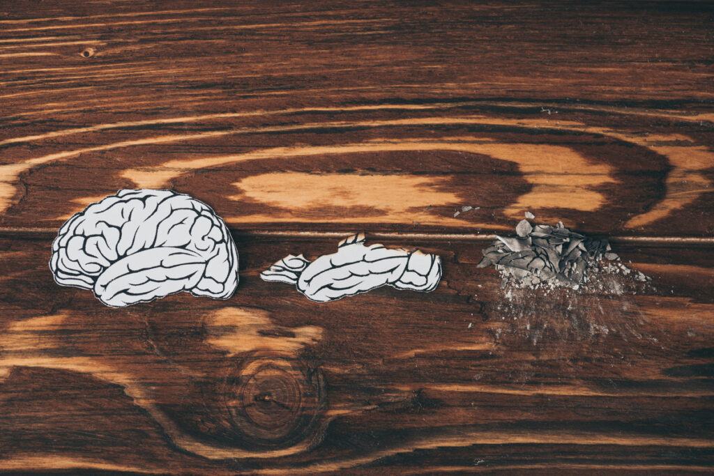 Картинка мозга постепенно сгорает на столе