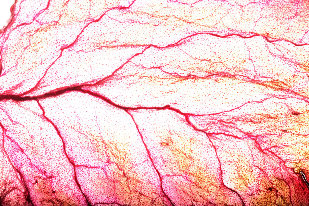 Визуализации сосудов