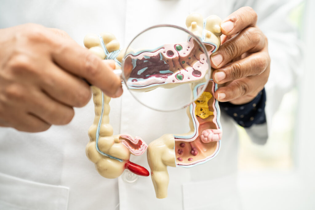 Врач держит анатомическую модель кишечника