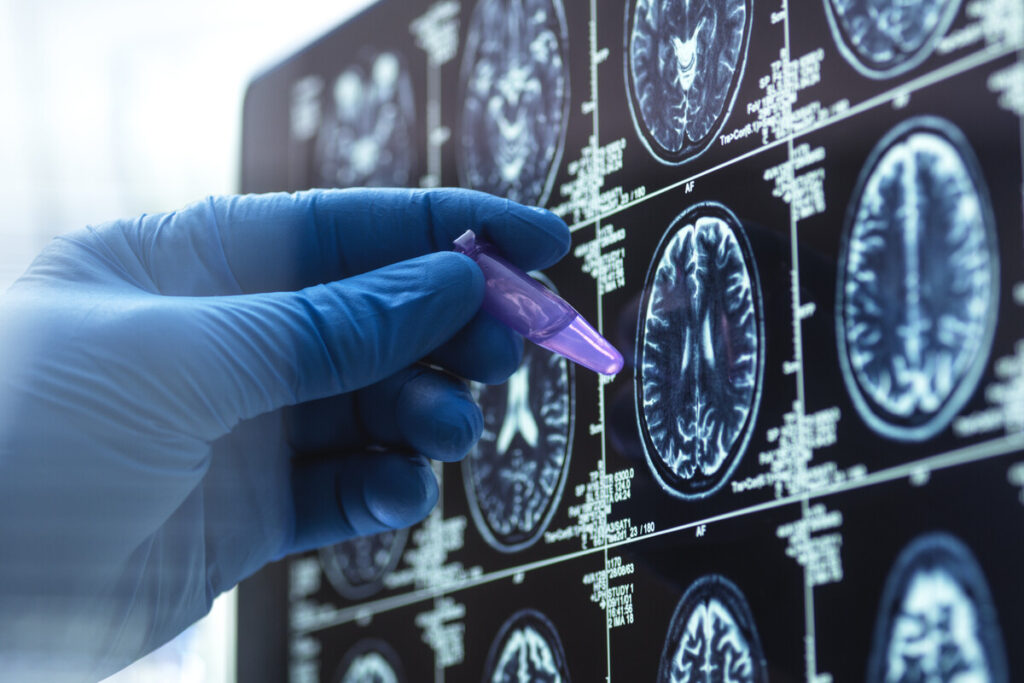 Изображения МРТ мозга