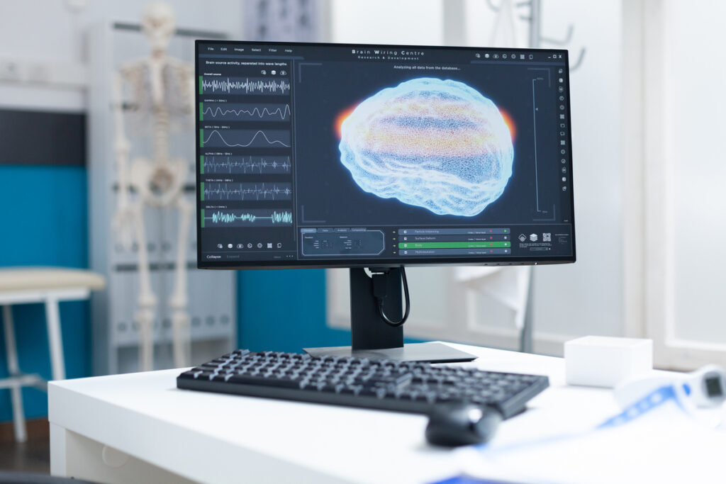 Монитор с компьютерной томографией мозга