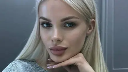 Избитая в Москве модель Тартанова открыла сбор средств на восстановление черепа