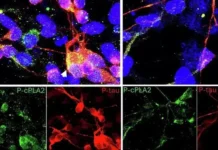 Университет Южной Калифорнии: лечение Альцгеймера через cPLA2 universitet yuzhnoj kalifornii lechenie alczgejmera cherez 2-journalrf-ru-0