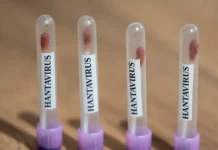Хантавирус. Мнение экспертов об Андском штамме и ГЛПС hantavirus mnenie ekspertov ob andskom shtamme i glps-journalrf-ru-0