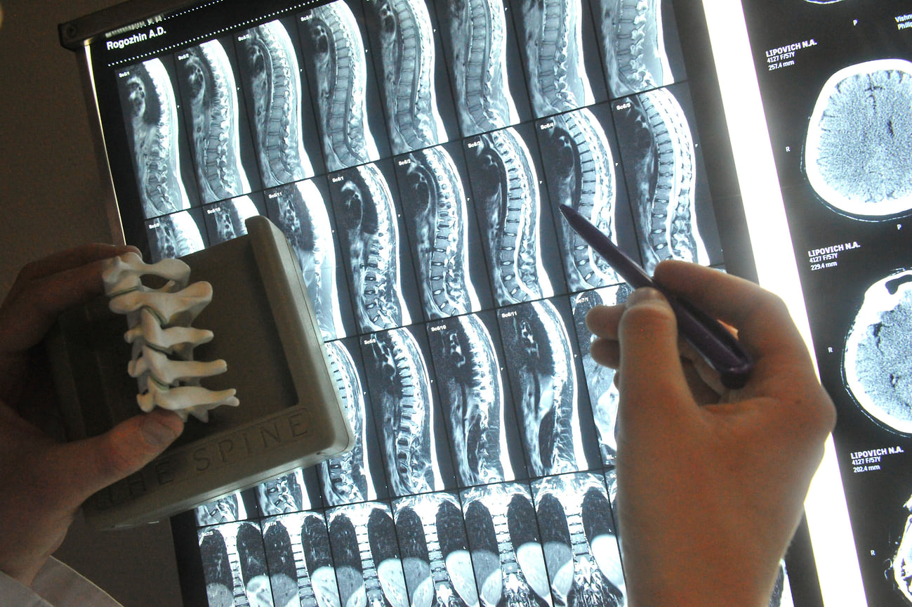 Прорыв в лечении спинальных травм: возвращение способности ходить c054e2df-7e7f-4505-aef9-971b492e4af3-67a4e882
