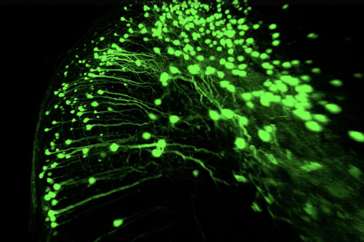 Революционное открытие нейронов памяти в головном мозге b16461c9-1de4-4a37-999b-eefac502cbd3-68004500