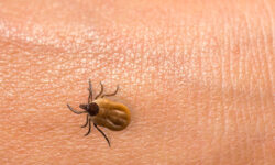 Георгий Сапронов о пробуждении клещей в Сибири Алтае и на Дальнем Востоке georgij sapronov o probuzhdenii kleshhej v sibiri altae i na dalnem vostoke-fabrec-ru-174327190700-0