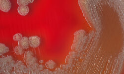 Роспотребнадзор контролирует 321 контакт в Москве после случая холеры у туриста из Индии VibrioCholeraeBacterialColoniesOnBloodAgarPlateAbstractMedical