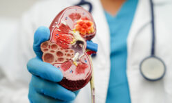 Антон Ротов предлагает простые шаги для поддержания здоровья почек при диабете и гипертонии ChronicKidneyDiseaseDoctorHoldingModelForTreatmentUrinarySystem