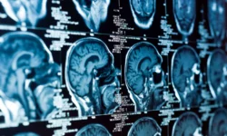 MIT сделала прорыв в лечении ETMR, открыв мишени FGFR и C19MC sdelala proryv v lechenii otkryv misheni i 19-fabrec-ru-174886887000-0