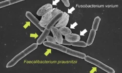 Кодзи Хосоми и его исследование роли бактерий Fusobacterium varium в microbiome kodzi hosomi i ego issledovanie roli bakterij v -fabrec-ru-0