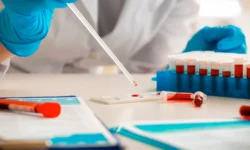 Обсуждение достижений AIRI и Сколковского института в измерении старения obsuzhdenie dostizhenij i skolkovskogo instituta v izmerenii stareniya-fabrec-ru-0