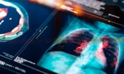 Ольга Уланкина из Гемотест подчеркивает важность профилактики ХОБЛ olga ulankina iz gemotest podcherkivaet vazhnost profilaktiki hobl-fabrec-ru-0